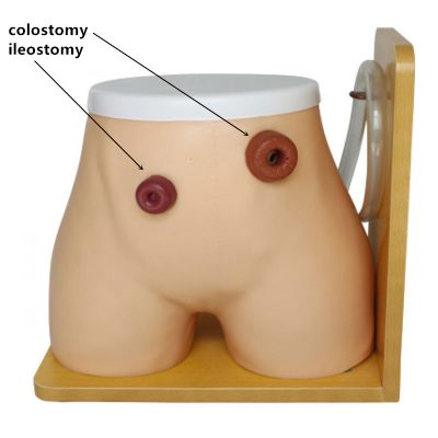 OSTOMY NURSING MODEL