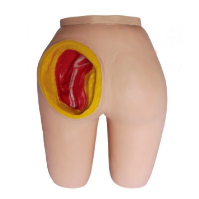 Advanced Gluteal IM Injection Model – Removable Buttock