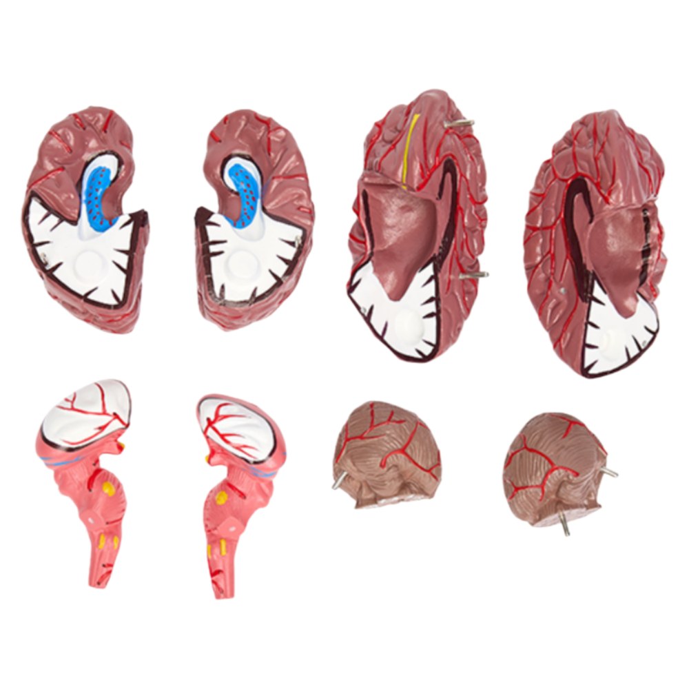 Brain with Arteries Model – Colour-Coded, 8 Parts - Image 2