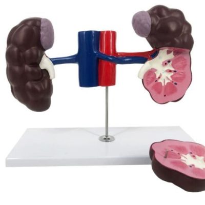 Cow Kidney Model