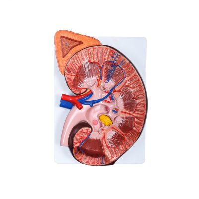 Enlarged Kidney Model – 3×, with Nephron Detail