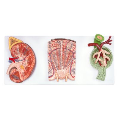 Enlarged Kidney, Nephron & Renal Corpuscle Model – 3 Parts