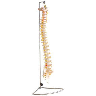 Flexible Vertebral Column – Life Size, with Herniated Disc