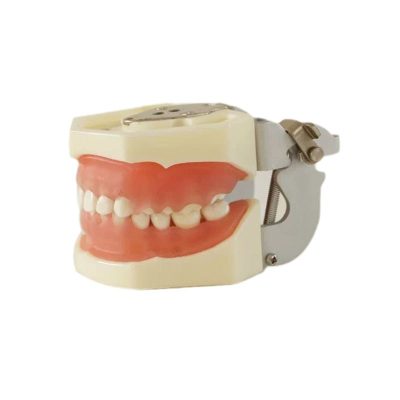 Gingival Diseases Model
