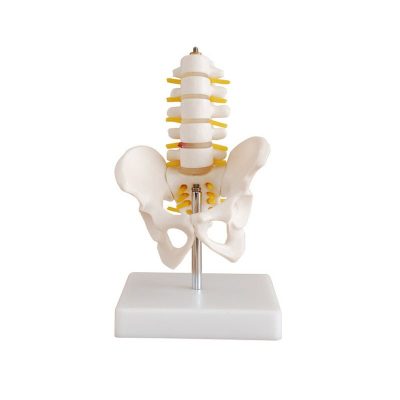 Half-Size Pelvis with 5 Lumbar Vertebrae