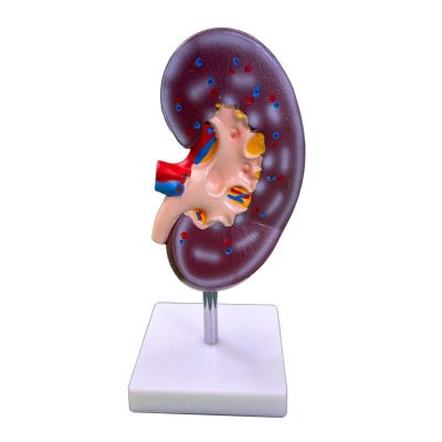 Kidney Section Model – 2× Enlarged, 1 Part