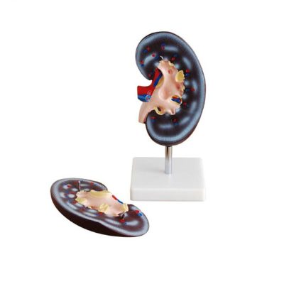Kidney Section Model – 2× Enlarged, 2 Parts