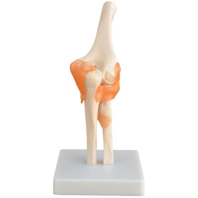 Life-Size Elbow Joint Model with Ligaments