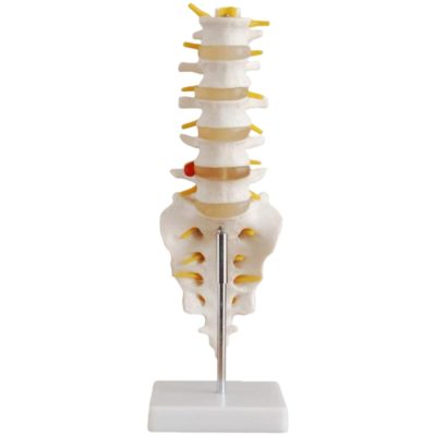 Life-Size Lumbar Spine with Sacrum, Coccyx & Herniated Disc