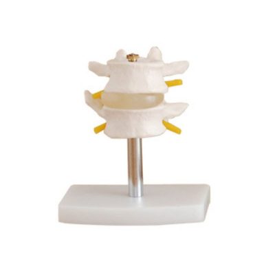 Lumbar Vertebrae Set – 2 Pieces