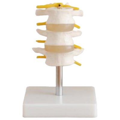 Lumbar Vertebrae Set – 3 Pieces