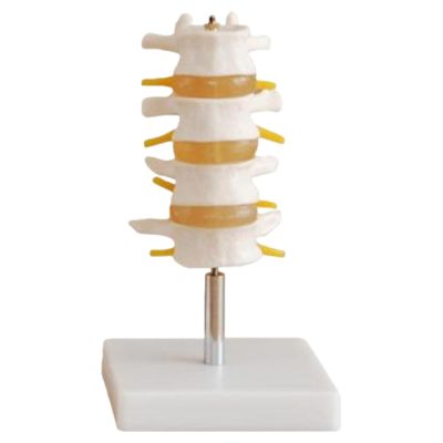 Lumbar Vertebrae Set – 4 Pieces