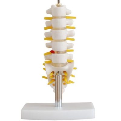 Mini Lumbar Spine with Sacrum, Coccyx & Herniated Disc