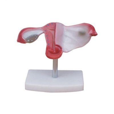 Natural-Size Uterus & Ovaries Model – Coronal Section