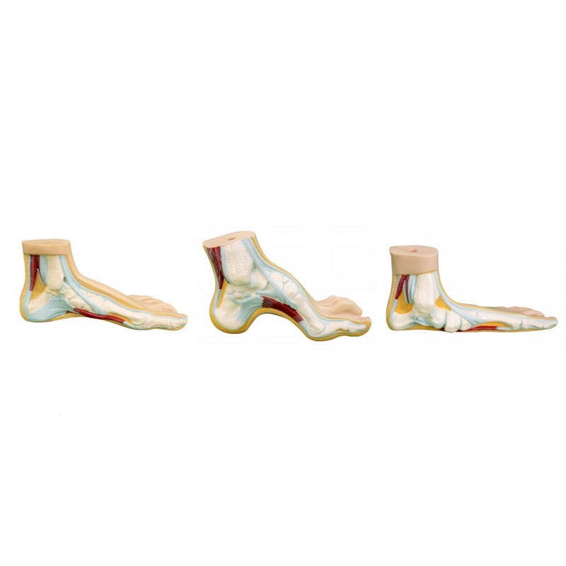 Normal, Flat & Arched Foot Model Set – 3 Pieces