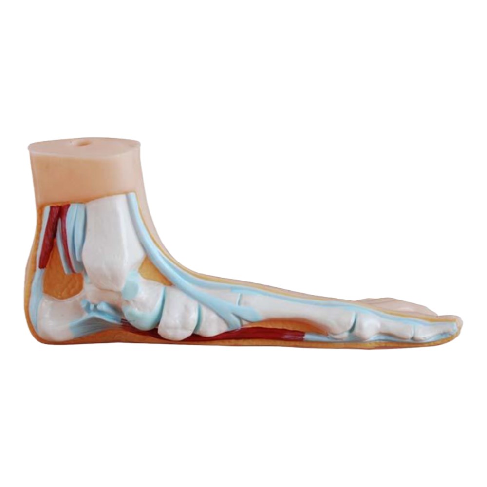 Normal, Flat & Arched Foot Model Set – 3 Pieces - Image 2