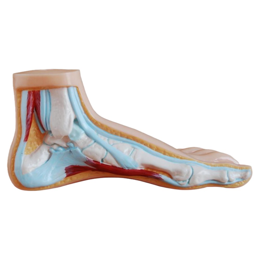 Normal, Flat & Arched Foot Model Set – 3 Pieces - Image 4