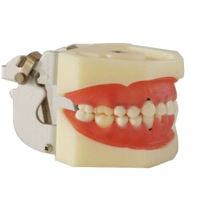 Periodontal Disease Model with Soft Gingiva – Furcation
