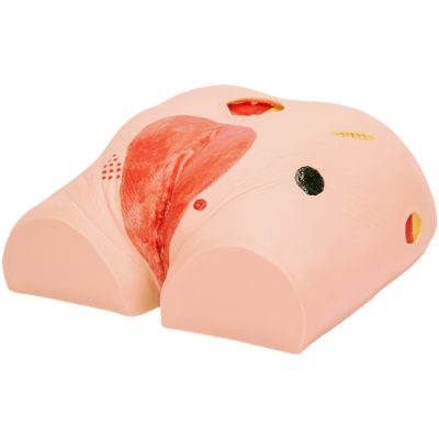 Pressure Ulcer (Decubitus) Wound Care Model – 4 Stages
