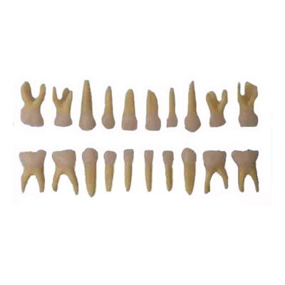 Primary (Deciduous) Teeth Model – 20 Teeth