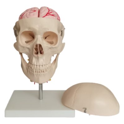 Skull with Cervical Spine & 8-Part Brain with Arteries